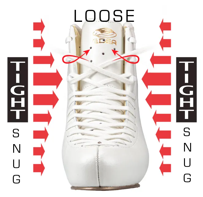 Why EDEA Skates U.S.